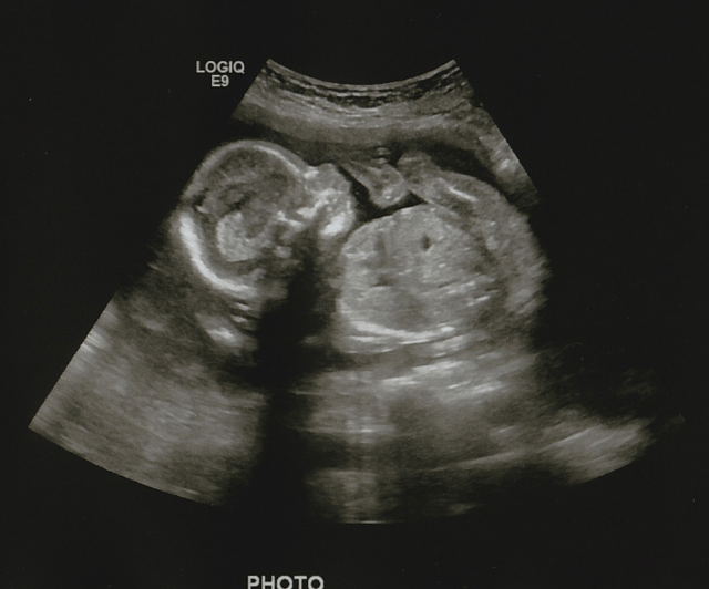 Baby_Boy_Profile_Body cropped